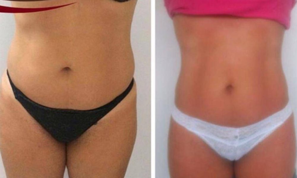 a1a43910110b2fd69cd7308c36b8d6a3_WhatsAppImage20230424at13.10.242